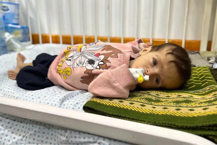 7 وفيات نتيجة التجويع في غزة خلال الساعات الماضية