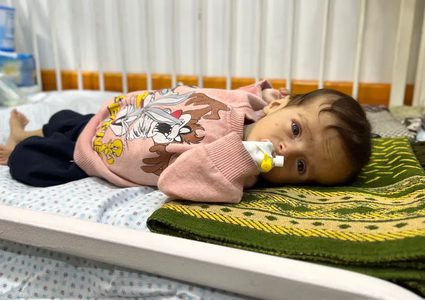 7 وفيات نتيجة التجويع في غزة خلال الساعات الماضية