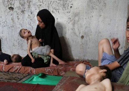 9 وفيات بينها 3 أطفال نتيجة التجويع في غزة خلال الـ24 ساعة الماضية