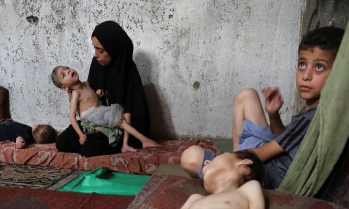 9 وفيات بينها 3 أطفال نتيجة التجويع في غزة خلال الـ24 ساعة الماضية