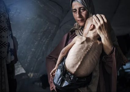 13 حالة وفاة بينها 3 أطفال نتيجة التجويع في غزة خلال الساعات الـ24 الماضية