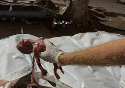 الاحتلال يحرق خيام النازحين ويستهدف سيارات الإسعاف في غزة