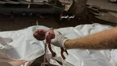 الاحتلال يحرق خيام النازحين ويستهدف سيارات الإسعاف في غزة