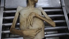 غزة.. 3 وفيات جديدة بالمجاعة ترفع الحصيلة إلى 376 ضحية