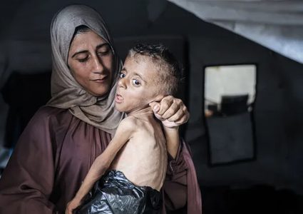 5 وفيات بينهم طفل نتيجة المجاعة وسوء التغذية خلال الـ24 ساعة الماضية
