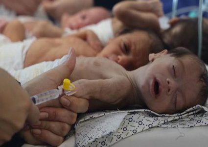 اليونيسف: سوء التغذيةيهدد  الأطفال في غزة ويتجاوز الرقم القياسي