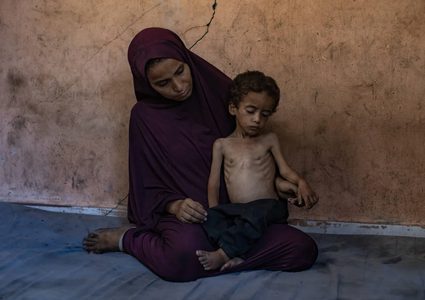 وفاة طفلة بسبب المجاعة بغزة لترتفع حصيلة الوفيات لـ 453