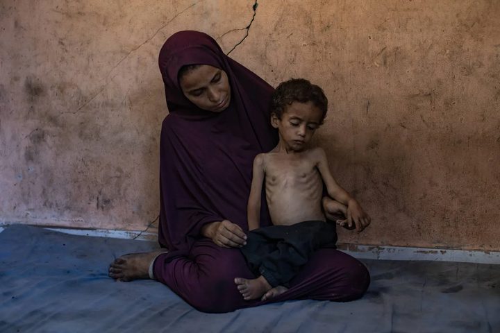 وفاة طفلة بسبب المجاعة بغزة لترتفع حصيلة الوفيات لـ 453