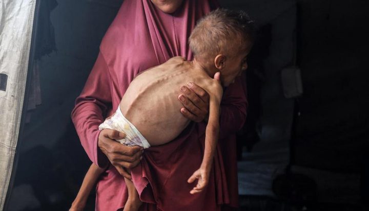 شيهدان أحدهما طفل نتيجة التجويع وسوء التغذية بغزة