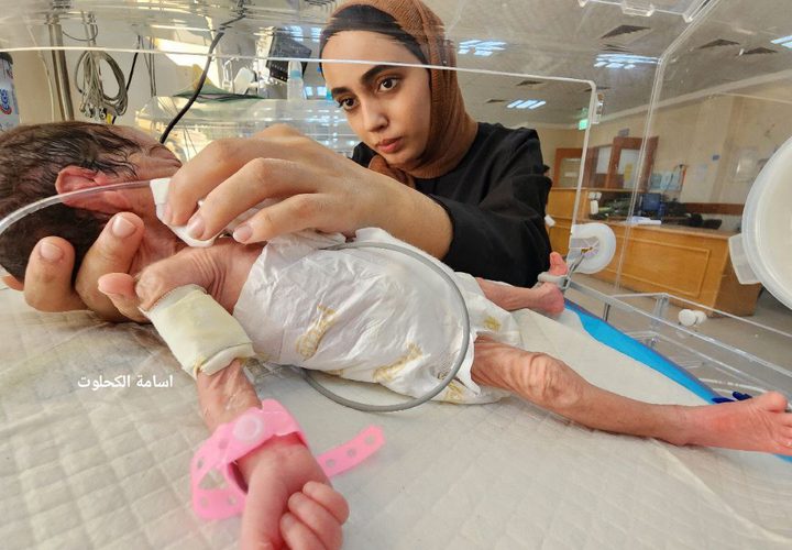 "تكدس الأطفال الخدج في حضانة الأقصى وسط نقص حاد بالأدوية"