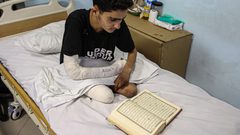 الصحة العالمية: 5 آلاف غزي تم بتر أطرافهم منذ بدء الحرب