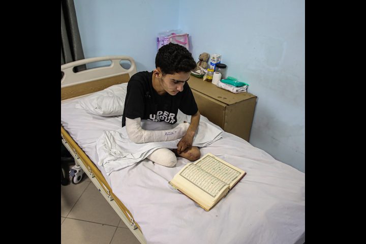 الصحة العالمية: 5 آلاف غزي تم بتر أطرافهم منذ بدء الحرب