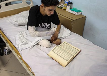 الصحة العالمية: 5 آلاف غزي تم بتر أطرافهم منذ بدء الحرب