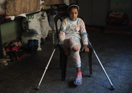 15 ألف مبتور أطرافهم واحتياجات طبية عاجلة في غزة