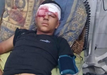 إصابة طفل بجروح خطيرة بقنبلة صوت أطلقها جنود الاحتلال صوب رأسه