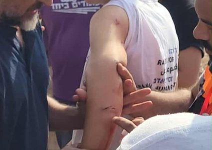 مستوطنون يعتدون على متضامنين قرب دير استيا