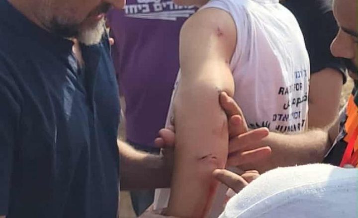 مستوطنون يعتدون على متضامنين قرب دير استيا