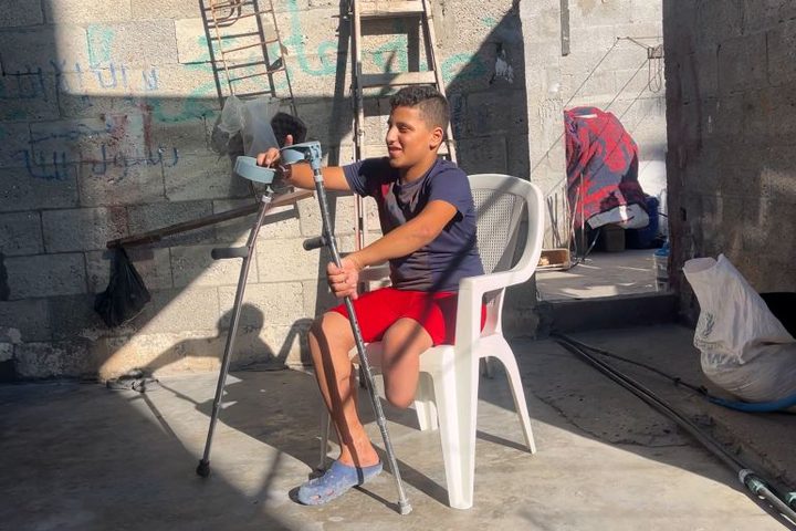 وزارة الصحة: غزة تسجّل أعلى معدل لبتر الأطراف لدى الأطفال نسبةً لعدد السكان عالم