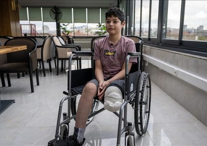 مصادر طبية: 6 آلاف حالة بتر في قطاع غزة