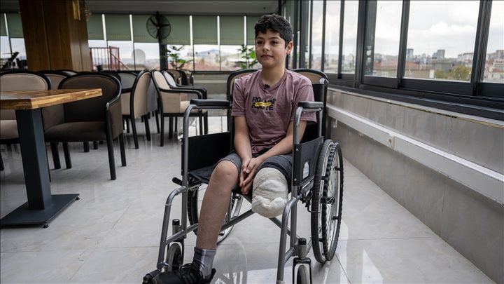 مصادر طبية: 6 آلاف حالة بتر في قطاع غزة