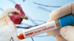 أول حالة وفاة بسبب سلالة نادرة من إنفلونزا الطيور في الولايات المتحدة