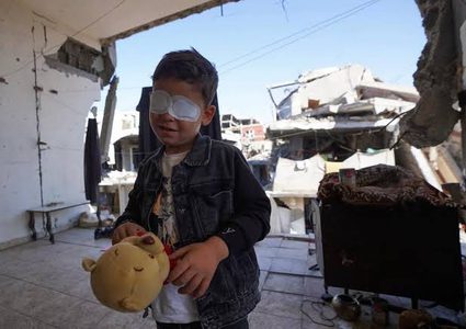 نقص حاد يهدد مرضى العيون و4 آلاف مهددون بفقدان البصر