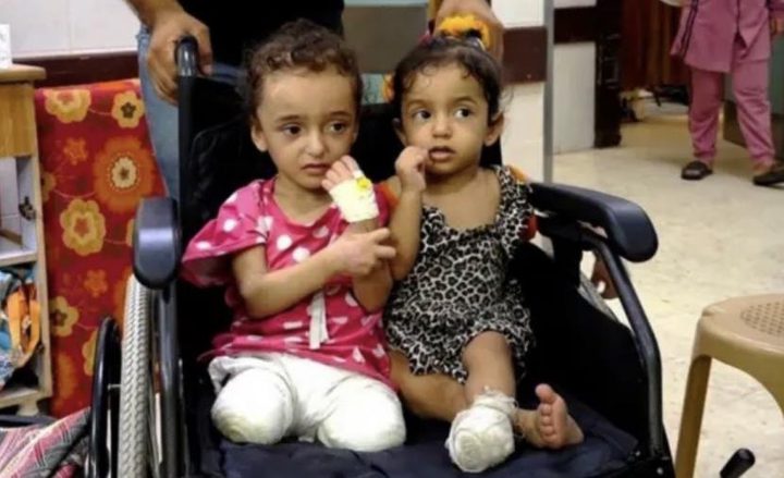 الصحة بغزة: 6000 حالة بتر خلال عامين وربع الضحايا أطفال
