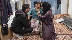 42 ألف شخص في غزة يعانون إصابات جسيمة تتطلب تأهيلا مستمرا