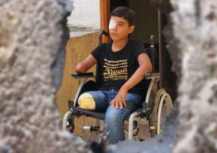 منظمة أمريكية تُحذّر: 6 آلاف مبتور في غزة يحتاجون إعادة تأهيل عاجل ودعم نفسي