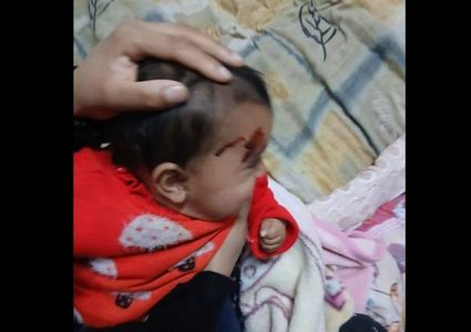 إصابة رضيعة في هجوم للمستوطنين على منازل المواطنين في بلدة سعير