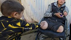 خرج ليطعم أسرته… فعاد بلا أطراف: قصة رائد الذي اغتالت الصواريخ رزق عائلته