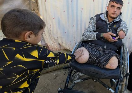 خرج ليطعم أسرته… فعاد بلا أطراف: قصة رائد الذي اغتالت الصواريخ رزق عائلته