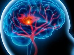 الموت المفاجىء: لماذا ترتفع معدلات الوفاة بين أوساط الشباب بالسكتات القلبية؟