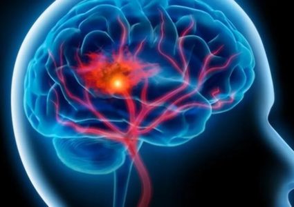 الموت المفاجىء: لماذا ترتفع معدلات الوفاة بين أوساط الشباب بالسكتات القلبية؟