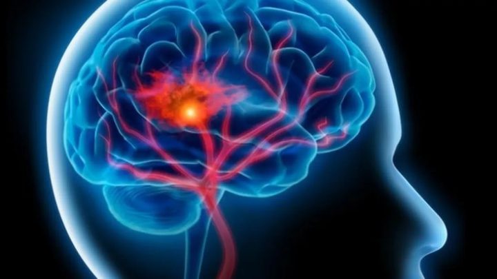 الموت المفاجىء: لماذا ترتفع معدلات الوفاة بين أوساط الشباب بالسكتات القلبية؟