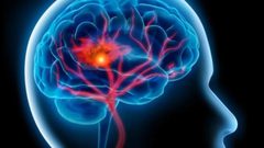 الموت المفاجىء: لماذا ترتفع معدلات الوفاة بين أوساط الشباب بالسكتات القلبية؟