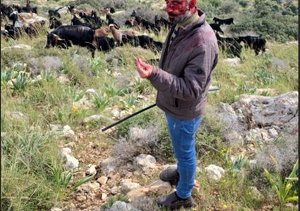 مستوطنون يعتدون بالضرب على راعٍ غرب سلفيت