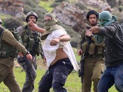 اصابة طفل باعتداء مستعمرين عليه في عورتا