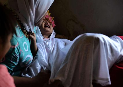 الأمم المتحدة: 4.5 مليون فتاة معرضات لخطر "ختان الإناث" في 2026