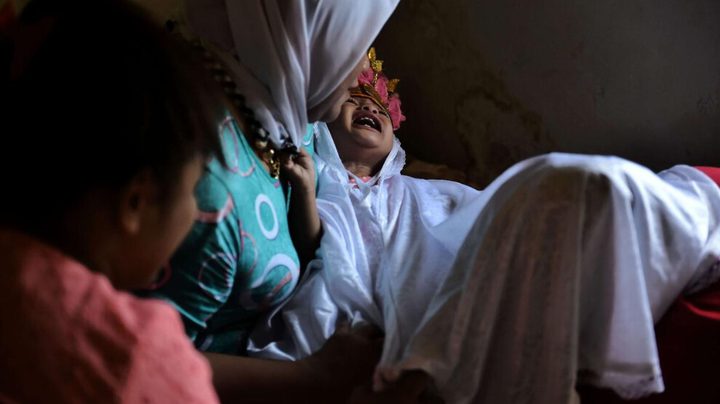 الأمم المتحدة: 4.5 مليون فتاة معرضات لخطر "ختان الإناث" في 2026