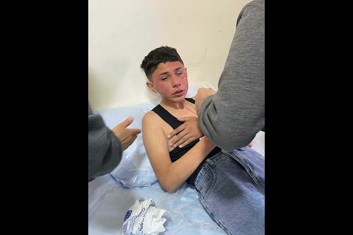 مستوطنون يعتدون على طفل جنوب نابلس