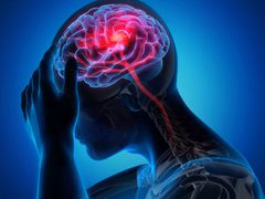 الجلطات الدماغية: ثالث أسباب الوفاة عالمياً وأحد أبرز مسببات الإعاقة