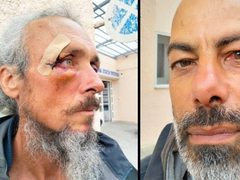 إصابة أكثر من 30 ناشطاً في العدوان الإسرائيلي على "أسطول الصمود"