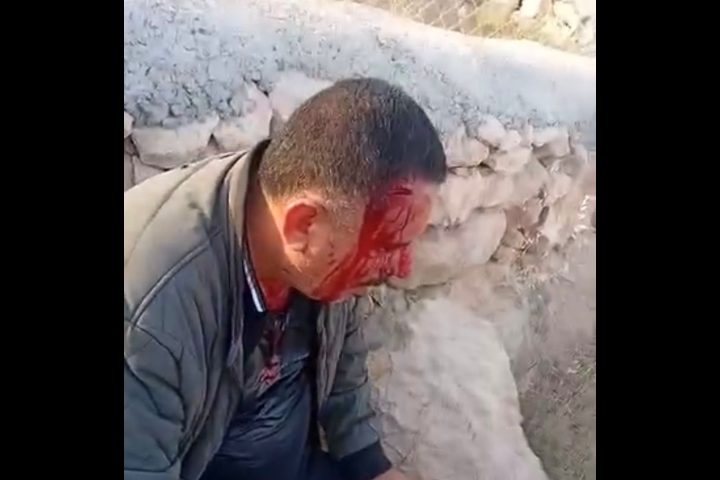 اصابة مواطن بجروح جراء اعتداء المستعمرين عليه