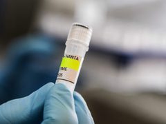تسجيل أول إصابة بفيروس هانتا في فرنسا