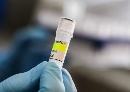 تسجيل أول إصابة بفيروس هانتا في فرنسا