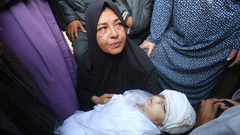 استشهاد طفلة متأثرة بجراحها جراء قصف الاحتلال مواصي خان يونس