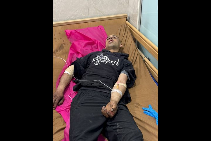 إصابة شاب طعنًا خلال هجوم للمستوطنين على منازل المواطنين في قصرة جنوب نابلس
