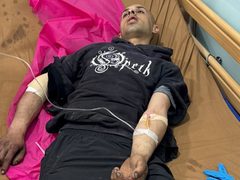 إصابة شاب طعنًا خلال هجوم للمستوطنين على منازل المواطنين في قصرة جنوب نابلس
