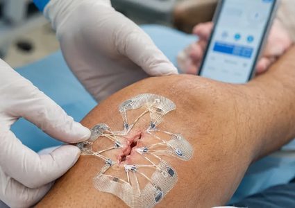 باحثون يطورون جهازاً يساعد في إغلاق الجروح وتسريع التئامها